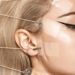 What do you know about the facial thread lift procedure and why it is good for you?